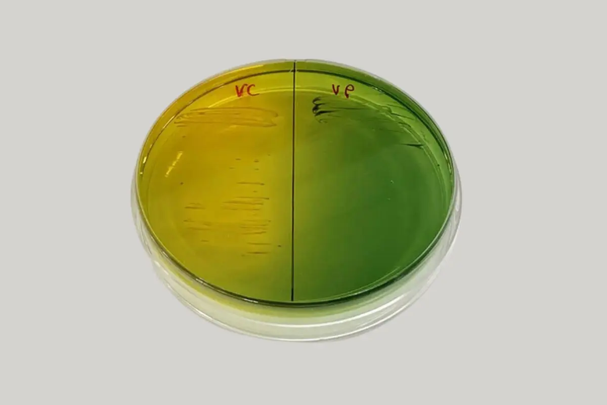 vibrio_1700192322